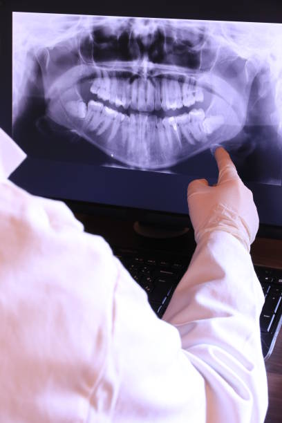 Best Teeth Whitening  in Otisville, NY