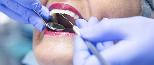 Best Knocked-Out Tooth Emergency  in Otisville, NY