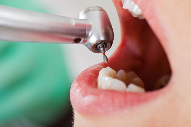 Best Broken Tooth Emergency  in Otisville, NY